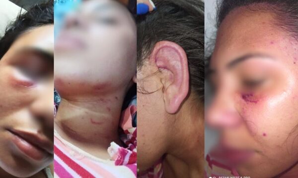 Joven víctima de violencia en Quiindy teme por su vida y la de sus hijos