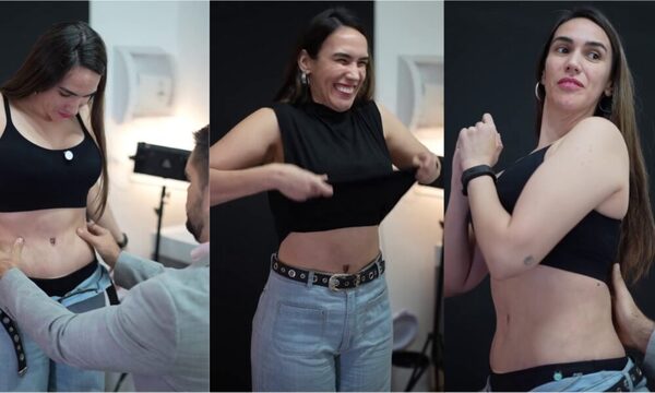 (VIDEO) A un mes de su operación, ¡Silvia Flores mostró cómo quedó su tuneado!