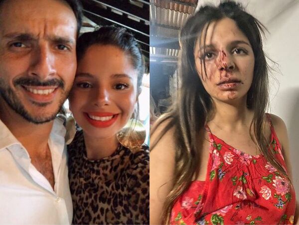 (VIDEO). Una mujer denuncia a su ex por garrotearla y amenazar de muerte a su mamá