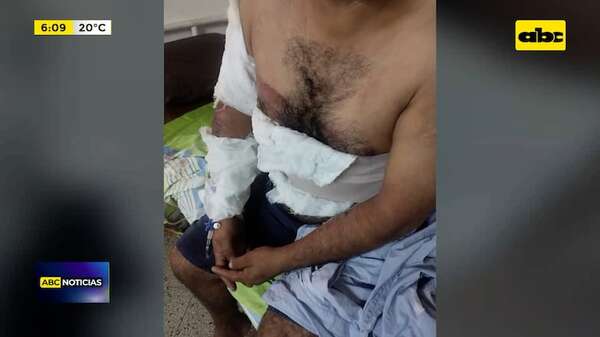 Video: Joven fue arrastrado por un automóvil en San Lorenzo - ABC Noticias - ABC Color