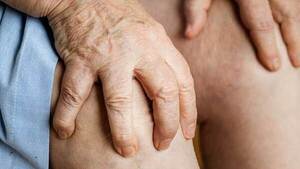 Pacientes sufren el dolor de la artritis porque quedaron sin medicamentos en IPS Central