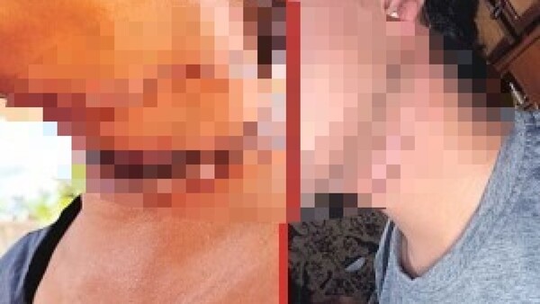 Cable suelto: “Si no me tiraba de la moto, me iba a decapitar o desnucar”