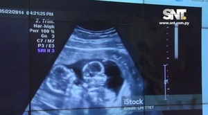 Médico niega autenticidad de ecografía presentada por madre de gemelos desaparecidos - SNT