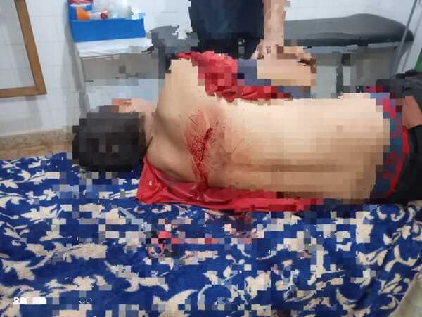 Un supuesto hecho de lesión con arma blanca en José Fassardi informó la policía