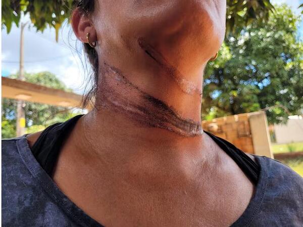 ¡Che Dios! Doñita y su hijo casi terminan decapitados por culpa de cables sueltos