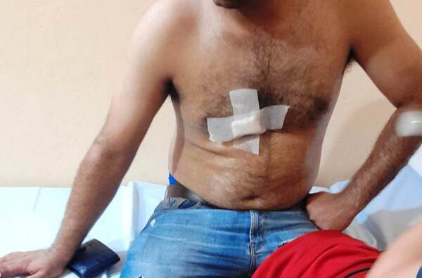 Vecinos reducen a joven que asaltó y acuchilló a motobolt •