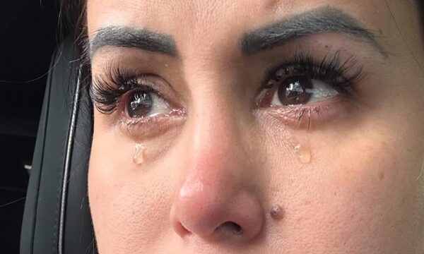 Jessica Sly recordó que las patadas de su ex le dejaron secuelas físicas