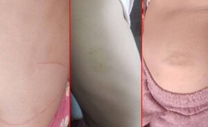 Cinco niñas víctimas de constantes agresiones por parte del padrastro
