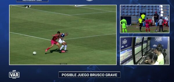 Versus / La roja que protestó todo Pedro Juan: "Se hizo del lente hū y corrió de mí"