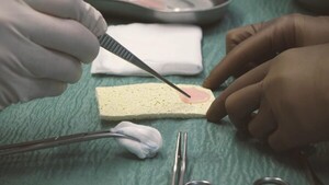 Parches musculares hechos de células madre pueden reparar corazones dañados, según estudio