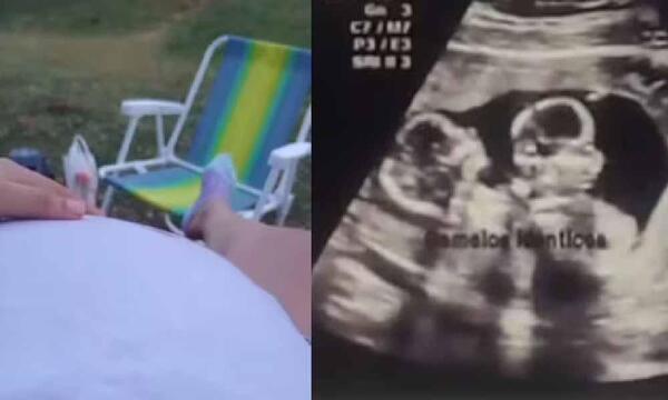 ¿Robo de bebés o embarazo psicológico?: Clínicas confirma que joven no llegó embarazada – Prensa 5