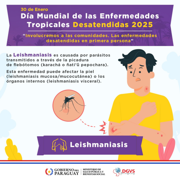Más de un centenar de afectados por leishmaniasis en el 2024, reporta Salud - .::Agencia IP::.