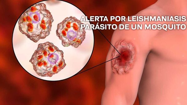 Día Mundial de las Enfermedades Tropicales: se reportó un centenar de casos de leishmaniasis