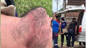Motociclista quedó con herida en el cuello a causa de cable colgado