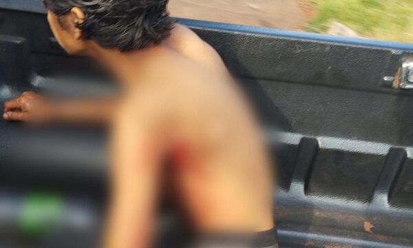 Joven en situación de calle es apuñalado en Franco