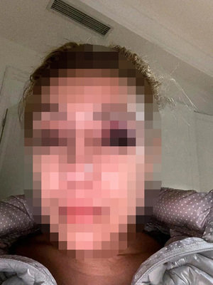 Policía celoso ataca a su pareja con una botella y dio un golpe de puño a la amiga de la mujer - La Clave