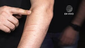 ¡Inervioso lo mitã!: Conductor atacó a otro con machete por un roce vehicular