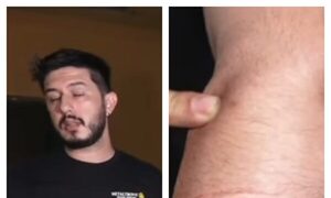 (VIDEO) Conductor fue macheteado por rozar otro vehículo