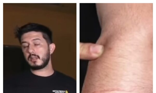 (VIDEO) Conductor fue macheteado por rozar otro vehículo