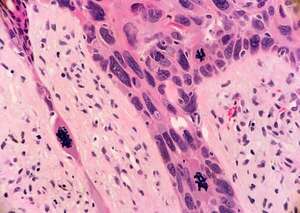 Entrenan una IA con “enorme” potencial para predecir cáncer y otras enfermedades - Tecnología - ABC Color