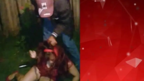 Hombre ataca brutalmente a mujer en Coronel Oviedo