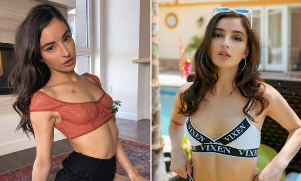 Estrella porno queda permanentemente discapacitada
