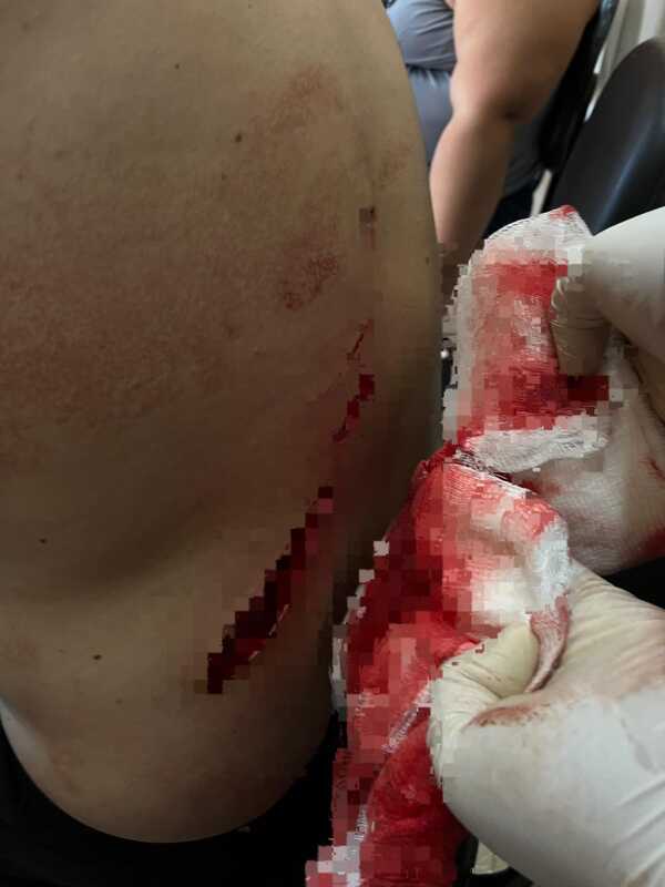 Buscan a sujeto que apuñaló a su propio hijo - La Clave