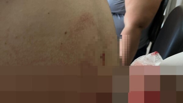 Quiso defender a su mamá y su papá lo acuchilló