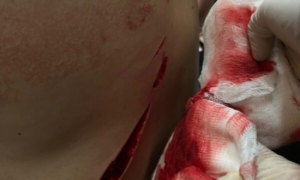 Fue para auxiliar a su madre, pero su padre lo acuchilló en la espalda – Diario TNPRESS