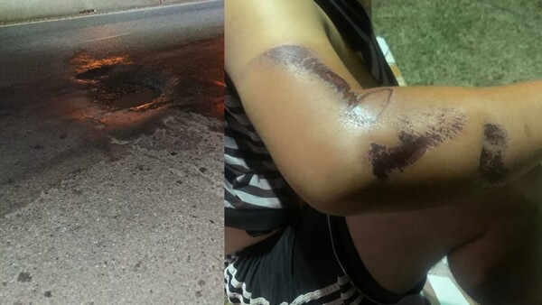 Motociclista casi muere por culpa de un bache en Capiatá