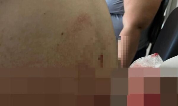 Joven ligó acuchillada por defender a su mamá de su propio padre