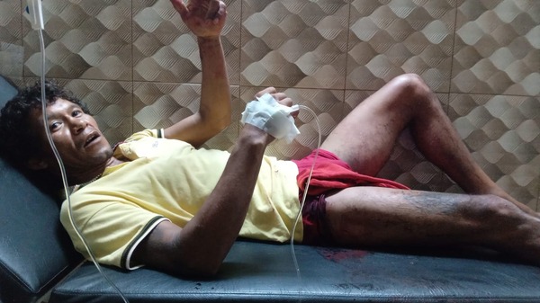 Hombre en situación de calle es baleado en Hernandarias: agresores están prófugos - ADN Digital