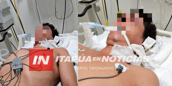 FALLECIÓ VÍCTIMA DE ATAQUE A BOTELLAZOS EN CAMBYRETÁ - Itapúa Noticias