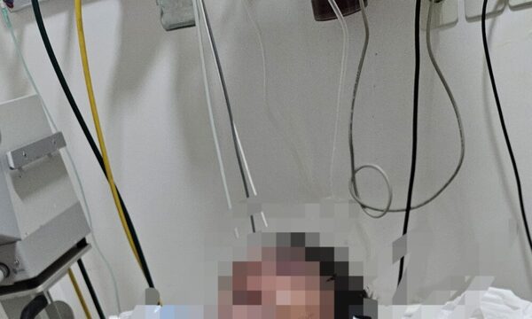 Por deuda de G. 5000 por truco, un joven se debate entre la vida y la muerte
