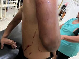Joven lucha por su vida tras violento ataque con cuchillo en Cambyretá