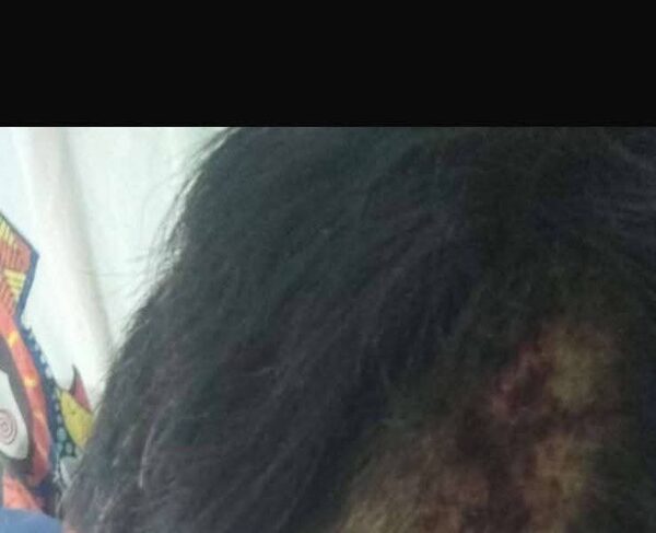 Hombre atacó a su padre y hermano con un mazo y un machete