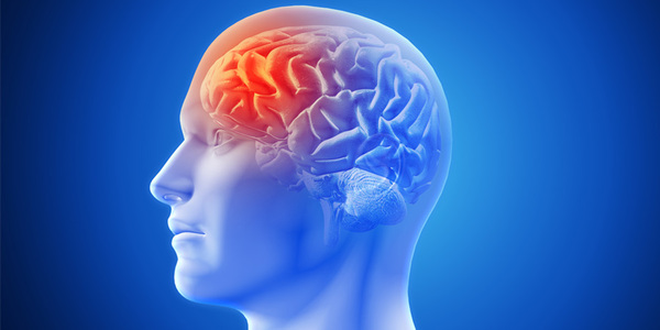 Cómo prevenir la migraña: diez alimentos ricos en tiramina que se deben evitar