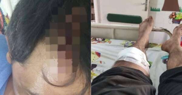 La Nación / Hombre atacó con mazo y machete a sus familiares en San José del Rosario