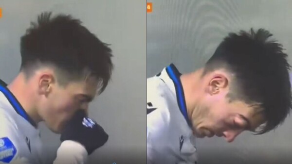 Futbolista casi perdió el ojo tras sonarse la nariz