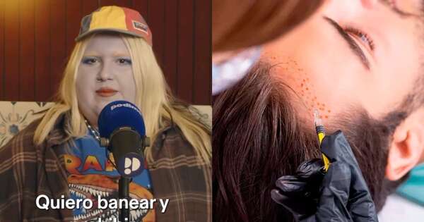 La Nación / Viral: influencer española quiere prohibir injertos de pelo en hombres