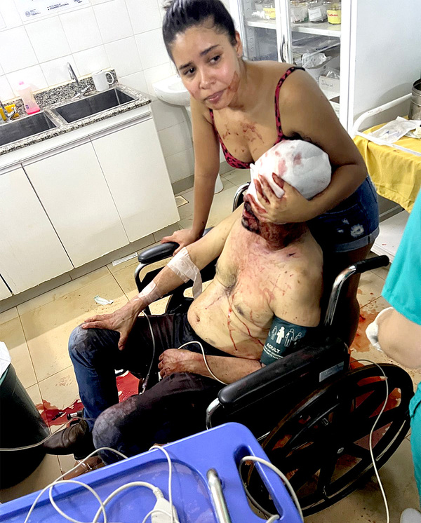 Sicarios balean a dos personas que iban en una camioneta en Minga Porã - La Clave