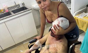 Dos heridos durante emboscada y ataque a balazos en una colonia de Minga Porã – Diario TNPRESS
