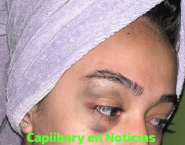 Ex yiyi de un músico denuncia que fue brutalmente golpeada