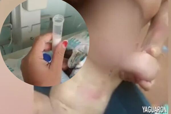 Bebé prematuro necesita ayuda para enfrentar problemas de salud - SNT