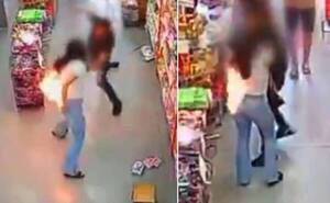 Por culpa de su celular ¡se quemó la cola!: le explotó el aparato en el bolsillo de atrás