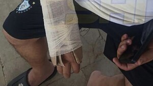 IPS San Antonio: Tuvo una fractura y le pusieron cartón en vez de yeso