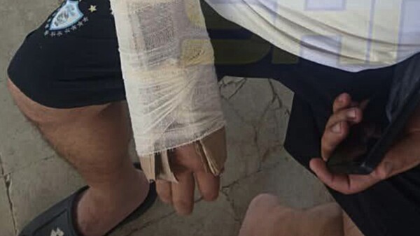 IPS San Antonio: Tuvo una fractura y le pusieron cartón en vez de yeso