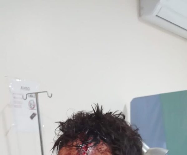 Cuñados le desfiguraron el rostro a machetazos