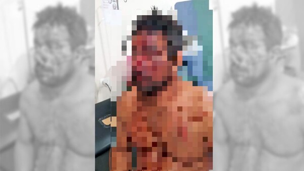 Fue atacado a machetazos por sus cuñados