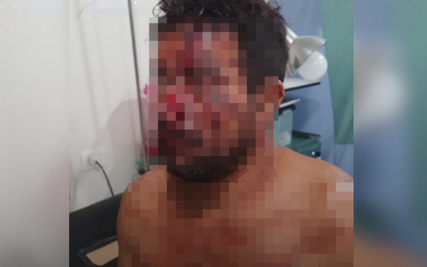 Hombre es atacado con machete por sus cuñados en Naranjal - Noticiero Paraguay